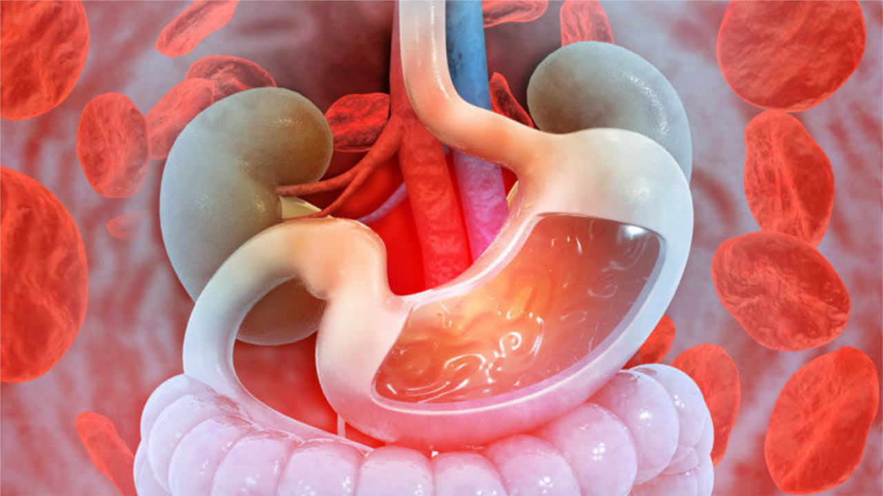 Upper gastrointestinal bleeding