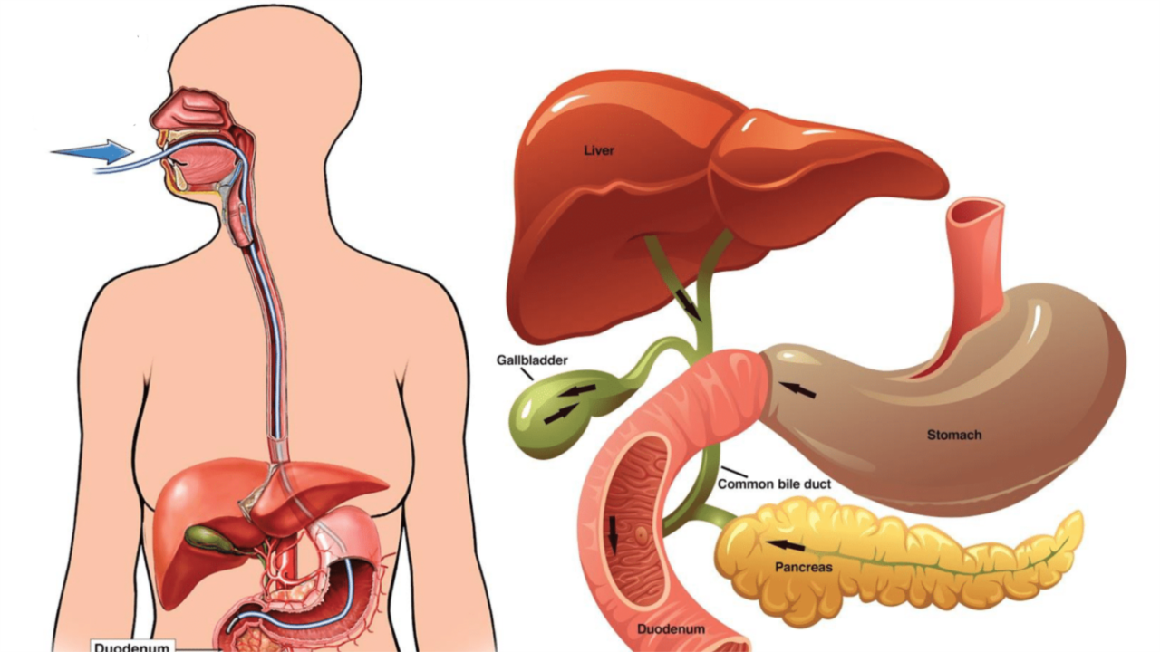 ERCP